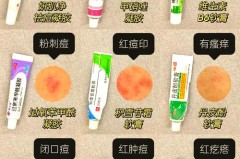 有痘痘的地方可以用磨砂膏么，有痘痘的地方可以用磨砂膏么吗