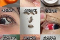刚戴隐形眼镜为什么磨眼睛_为什么戴隐形眼镜会磨眼