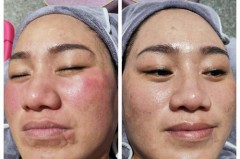 便宜的补水仪可信吗，补水仪哪里有卖
