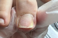 涂了指甲油泡热水有危害吗_涂了指甲油泡冷水可以干的更快吗