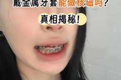 冲牙器过安检需要拿出来吗，冲牙器能带上火车吗