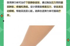 静脉曲张袜一级的好还是二级的好_医用静脉曲张袜一级和二级区别