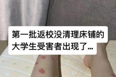 宿舍怎么用蟑螂药，宿舍有蟑螂用什么药