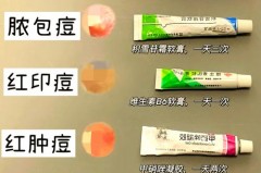 有痘痘的地方可以用磨砂膏么，有痘痘能用磨砂膏吗