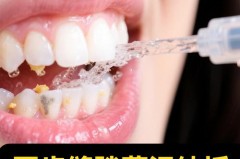 冲牙器里面的水每次都需要处理干净吗，冲牙器进水质量问题吗？