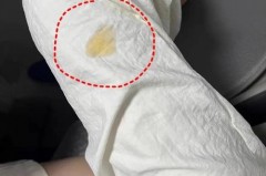 裤子上的血怎么能洗下去_裤子上血迹怎么清理