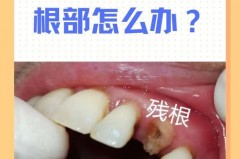 牙线卡在牙缝里会自己脱落吗，牙线卡住牙齿怎么办？