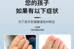 网红脚趾环可以瘦腿吗_脚趾环真的能改善腿型吗