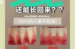 用了冲牙器牙龈萎缩了怎么回事，冲牙器用久了牙龈会萎缩吗