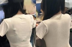 内衣下围勒出红痕是正常的吗，内衣下围勒出红痕是正常的吗图片？