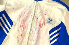 衣服上小黑点是虫子屎么，衣服上有小黑点