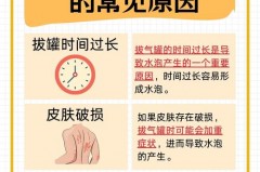 拔火罐起水泡怎么处理方法，拔火罐起水泡怎么去除