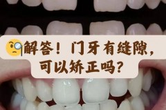 有必要用牙缝刷吗_长期用牙缝刷,会把牙缝刷的更大吗?