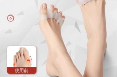 网红脚趾环可以瘦腿吗_脚趾环可以让腿变直吗