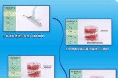 冲牙器里面长青苔怎么清洁，冲牙器里面怎么清洗？