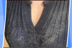 挂烫机可以去除衣服上的毛毛吗_挂烫机上面的毛刷怎么去掉