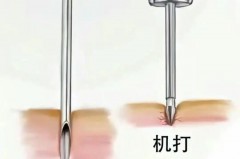 一次性穿耳器是手打还是枪打，一次性穿耳器好还是枪打得好