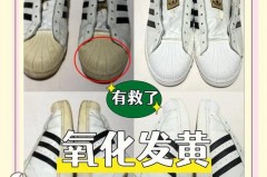 鞋子氧化发黄怎么变白_鞋子氧化发黄怎么处理最有效