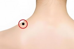 肩有痣穷一生是真的吗，肩膀有痣的是什么命运，肩部有痣好吗？