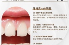 用牙线牙缝会不会变大_用牙线会把牙缝撑大吗