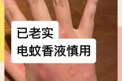 蚊香液弄到手上会怎么样，蚊香液倒在了手上有危险吗
