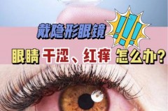 戴隐形眼镜感觉眼睛里有异物怎么办_戴隐形眼镜时感觉眼中有异物怎么办