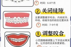 冲牙器使用时张开嘴还是闭嘴，冲牙器是张着嘴用还是闭嘴用？