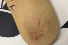 麂皮绒的鞋子发霉能洗干净吗_麂皮绒鞋面发硬怎么办