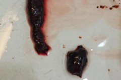 月经带是什么样的图片_月经带是怎么形成的