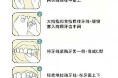 补完牙牙线进不去正常吗_补牙后牙线进不去 正常吗