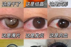 美瞳不常戴怎么保存，美瞳长期不用怎么放？