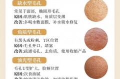 毛孔粗大用收敛水有用吗_毛孔粗大用收敛水有用吗女生
