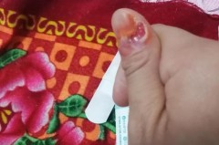 花露水涂在脚心有什么功效，花露水喷在脚上有坏处吗