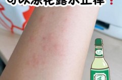 花露水涂了之后火辣辣的正常吗，花露水涂完火辣辣？