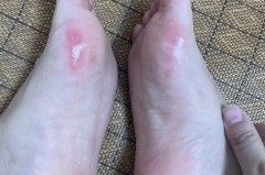 拖鞋磨脚是质量问题吗_拖鞋磨脚是质量问题吗知乎