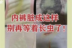 内裤穿三个月的就有细菌了吗，内裤3个月以上不扔掉的后果