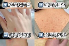 牛仔裤穿着痒是怎么回事_刚买的牛仔裤穿上有点痒