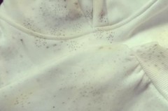 为什么短袖背后全是黑点点，为什么短袖后背上有点点