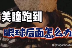 什么情况下美瞳会掉出来_美瞳的原因