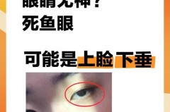 死鱼眼是什么样子的，死鱼眼是什么样子的面相？