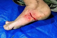 水蛭是什么东西_水蛭有什么作用和功效