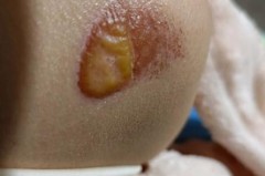 花露水喷到水果还能吃吗，花露水喷到口里怎么办？