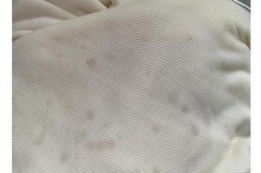 裤子泡白了有办法吗_白裤子泡变色了怎么办