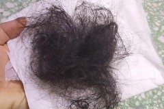 一梳头发就掉很多头发的原因_小孩子一梳头发就掉很多头发的原因
