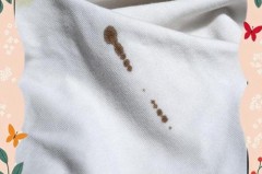 白衣服粘毛干了会掉吗，白衣服粘毛干了会掉吗图片？