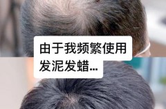 头上有发泥能睡觉吗_头发里的泥