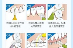 是先刷牙还是先用牙缝刷_是先刷牙还是后刷牙