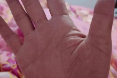 洗衣粉烧手是怎么回事_洗衣粉烧手怎么办