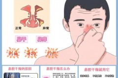 鼻子不通气用加湿器管用不，鼻塞可以用加湿器缓解吗？